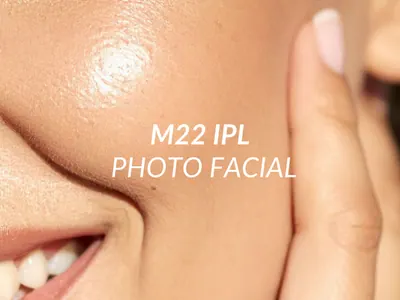M22 IPL photofacial for pigmentation and sun damage at Beauty Ranch Los Angeles