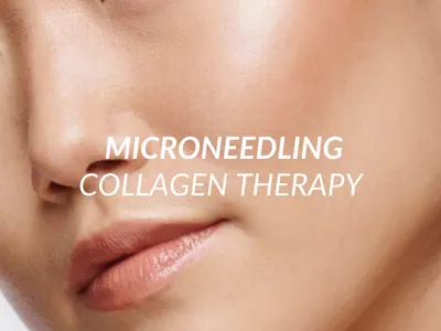 Professional microneedling collagen therapy treatment at Beauty Ranch Los Angeles
