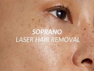 Laser hair removal in Brentwood — Soprano Titanium for all skin types at Beauty Ranch