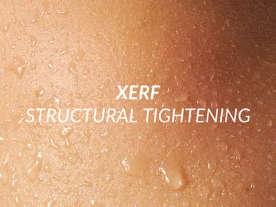 XERF structural skin tightening treatment from Korea at Beauty Ranch Los Angeles