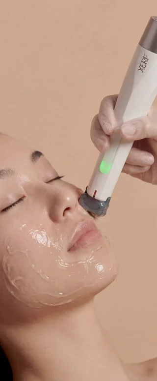 XERF radiofrequency skin tightening treatment on the face at Beauty Ranch Medical Spa Brentwood