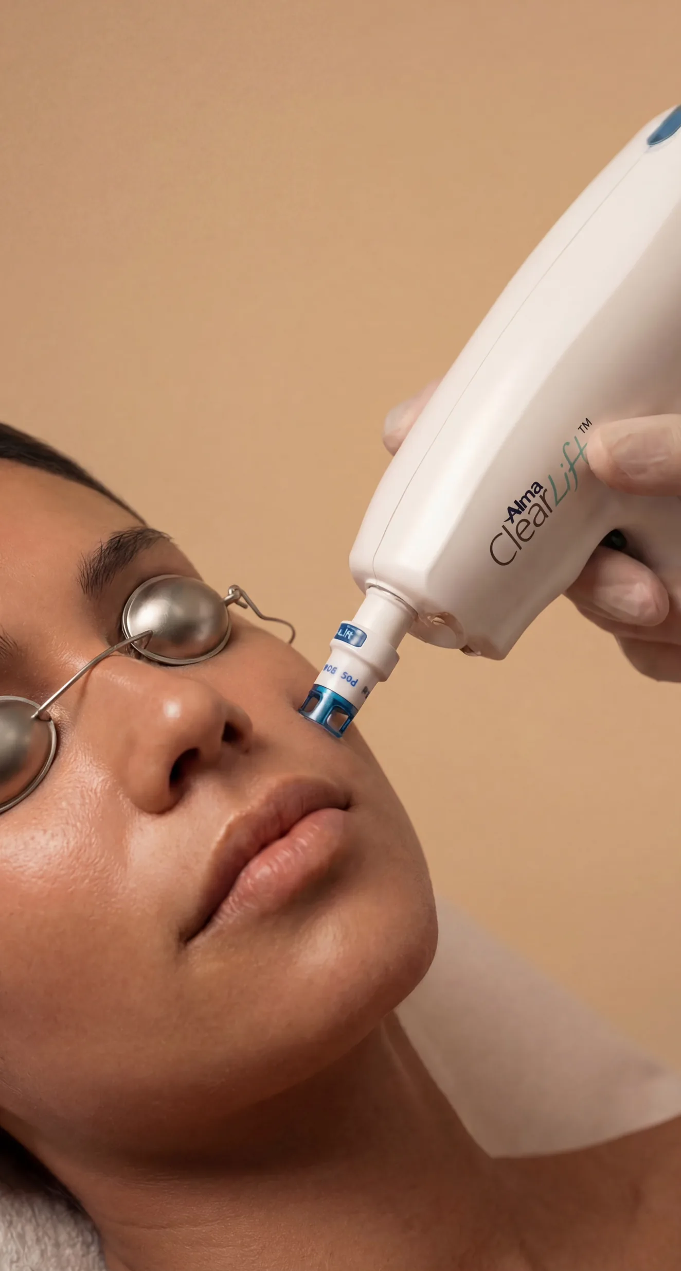 ClearLift treatment detail at Beauty Ranch Medical Spa
