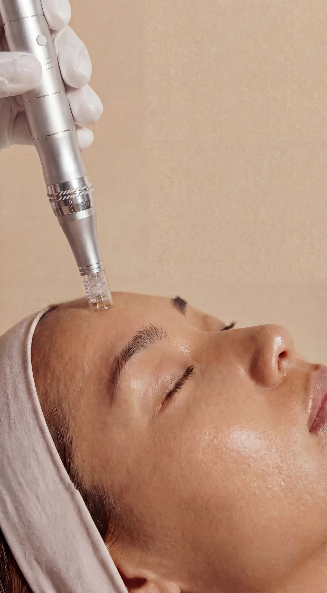 Microneedling treatment detail at Beauty Ranch Medical Spa