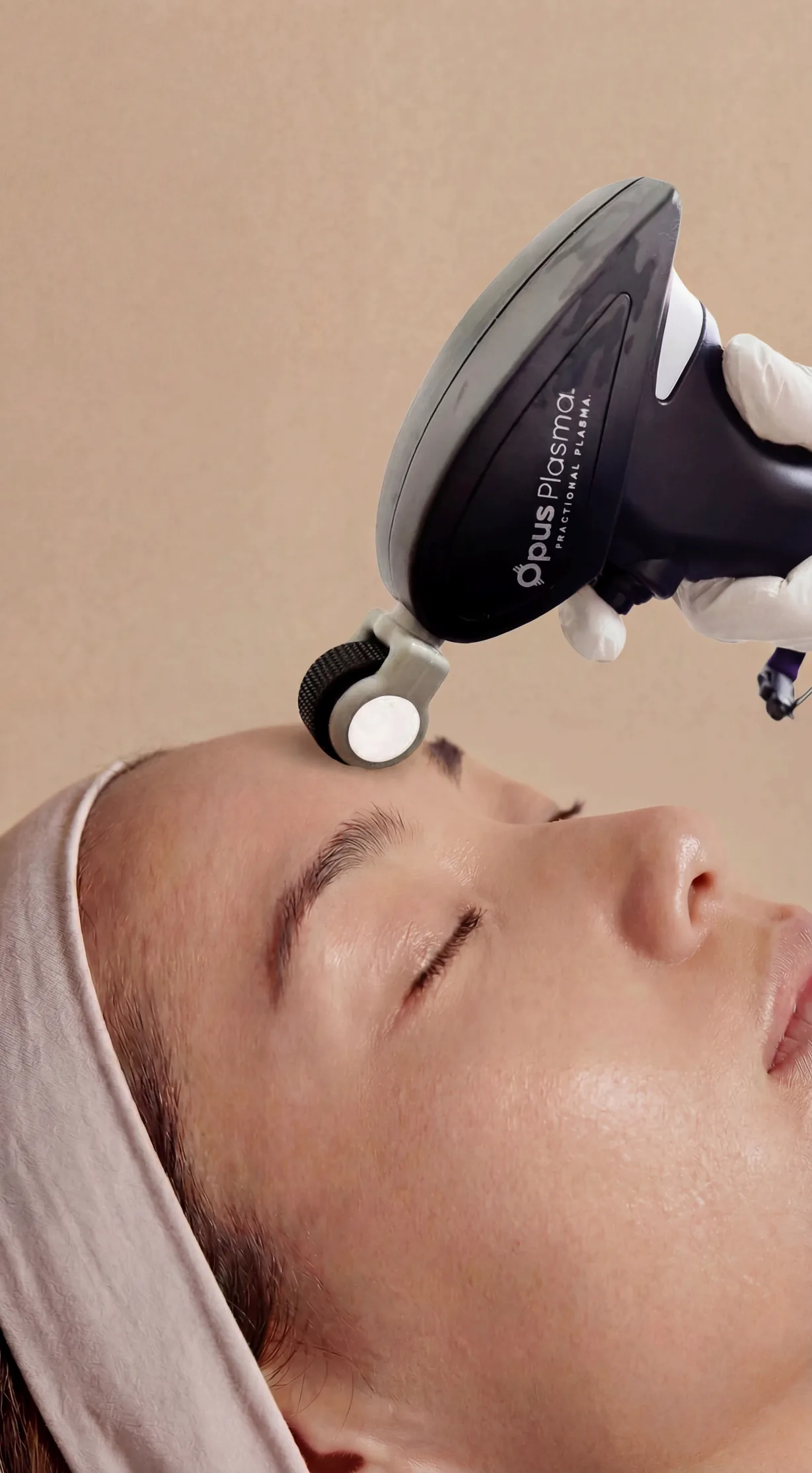 Opus Plasma treatment detail at Beauty Ranch Medical Spa
