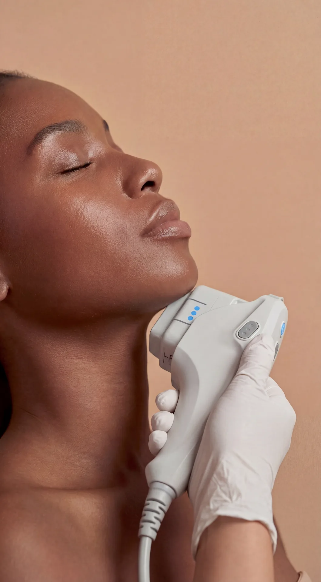 Ultherapy treatment detail at Beauty Ranch Medical Spa
