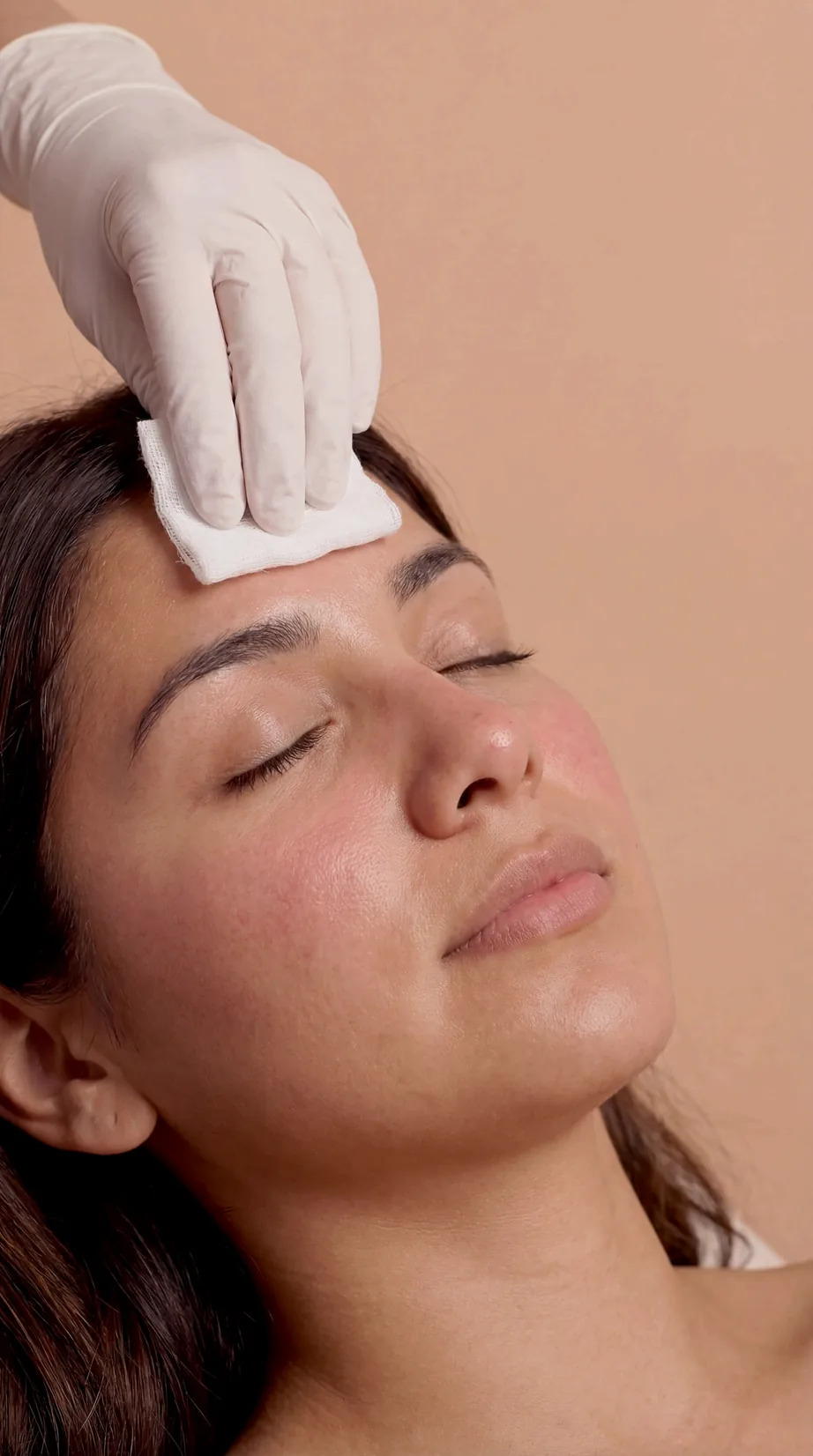 VI Peel treatment detail at Beauty Ranch Medical Spa
