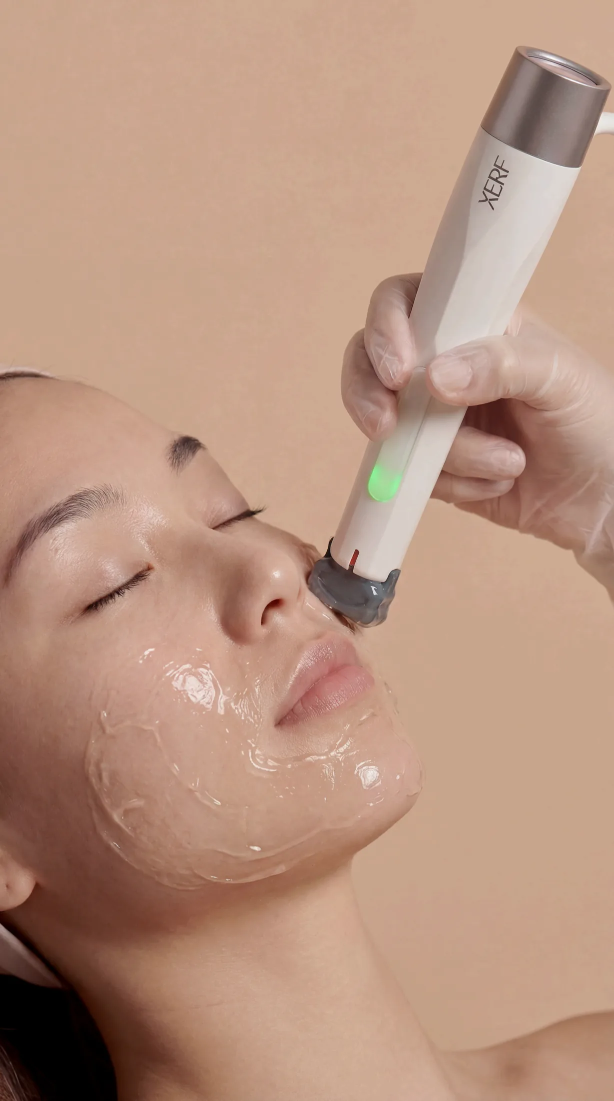Xerf treatment detail at Beauty Ranch Medical Spa